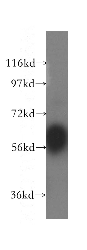 HeLa cells were subjected to SDS PAGE followed by western blot with Catalog No:112057(KNG1 antibody) at dilution of 1:300