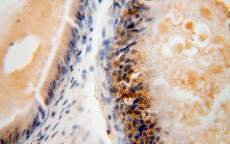 Immunohistochemical of paraffin-embedded human epididymis using Catalog No:113171(NGDN antibody) at dilution of 1:50 (under 40x lens)