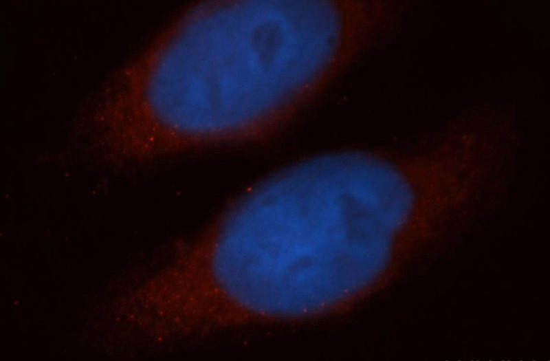 Immunofluorescent analysis of MCF-7 cells, using AGBL2 antibody Catalog No:107915 at 1:50 dilution and Rhodamine-labeled goat anti-rabbit IgG (red). Blue pseudocolor = DAPI (fluorescent DNA dye).