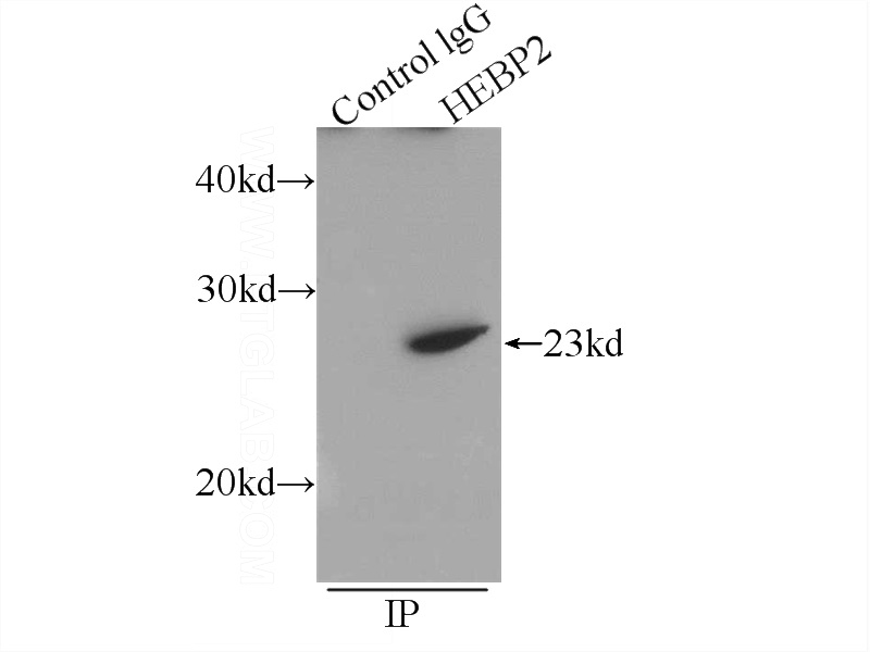 IP Result of anti-HEBP2 (IP:Catalog No:111395, 3ug; Detection:Catalog No:111395 1:500) with HEK-293 cells lysate 2400ug.