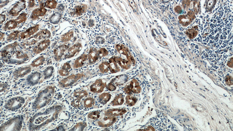 Immunohistochemical of paraffin-embedded human stomach using Catalog No:109226(CHIA antibody) at dilution of 1:50 (under 10x lens)