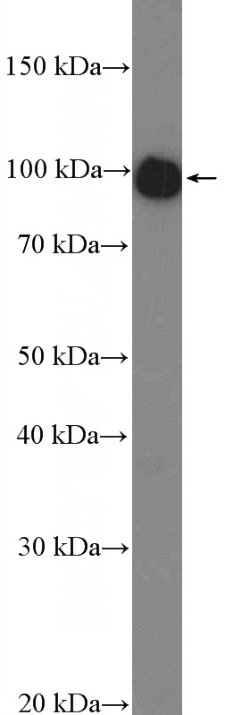 mouse skeletal muscle tissue were subjected to SDS PAGE followed by western blot with Catalog No:114361(PYGM-Specific Antibody) at dilution of 1:1000