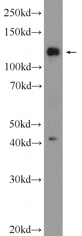 HEK-293 cells were subjected to SDS PAGE followed by western blot with Catalog No:110736(FNDC3A Antibody) at dilution of 1:1000