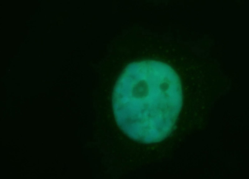 Immunofluorescent analysis of Hela cells, using CUGBP1 antibody Catalog No:109739 at 1:50 dilution and FITC-labeled donkey anti-rabbit IgG (green). Blue pseudocolor = DAPI (fluorescent DNA dye).