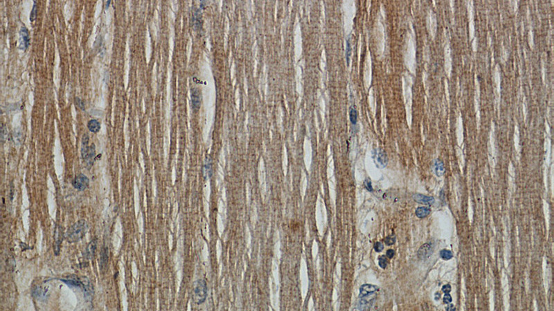 Immunohistochemistry of paraffin-embedded human skeletal muscle slide using Catalog No:109199(CFLAR Antibody) at dilution of 1:50