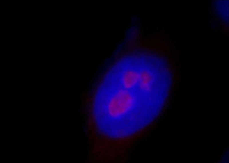 Immunofluorescent analysis of Hela cells, using RRP8 antibody Catalog No:114930 at 1:25 dilution and Rhodamine-labeled goat anti-rabbit IgG (red).Blue pseudocolor = DAPI (fluorescent DNA dye).