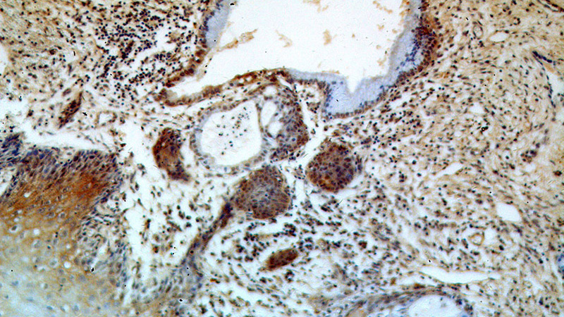 Immunohistochemical of paraffin-embedded human cervix using Catalog No:110474(ESR2 antibody) at dilution of 1:50 (under 10x lens)