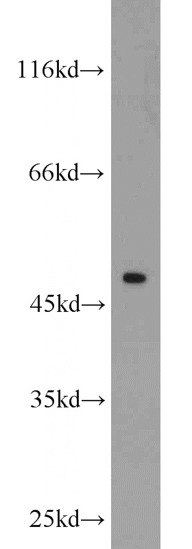 Jurkat cells were subjected to SDS PAGE followed by western blot with Catalog No:116985(XIAP antibody) at dilution of 1:1000