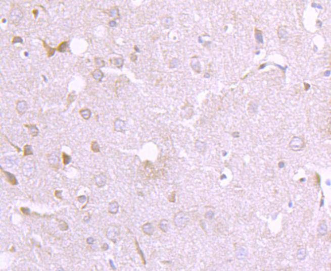 Fig6: Immunohistochemical analysis of paraffin-embedded rat brain tissue using anti-EIF2C3 antibody. Counter stained with hematoxylin.