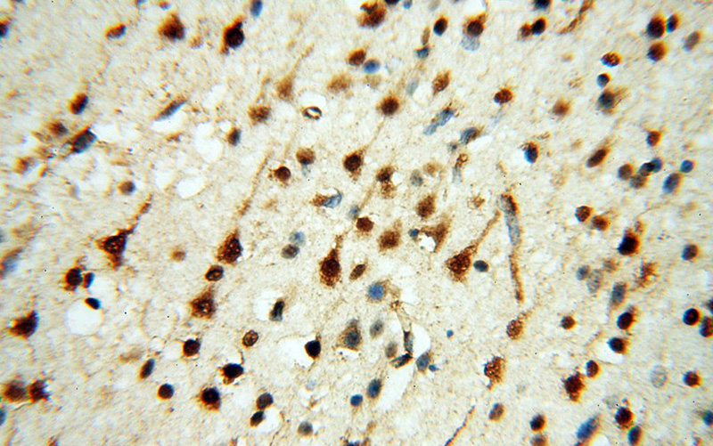 Immunohistochemical of paraffin-embedded human brain using Catalog No:116894(YTHDF1 antibody) at dilution of 1:100 (under 40x lens)