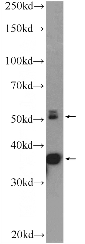 rat skeletal muscle tissue were subjected to SDS PAGE followed by western blot with Catalog No:108818(CALCocO2 Antibody) at dilution of 1:1000