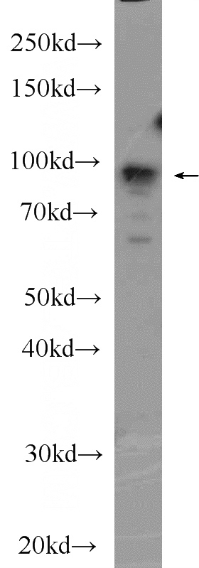 PC-3 cells were subjected to SDS PAGE followed by western blot with Catalog No:112421(LZTS2 Antibody) at dilution of 1:300