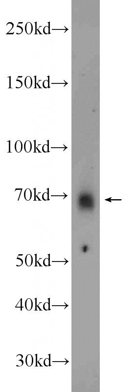 HeLa cells were subjected to SDS PAGE followed by western blot with Catalog No:112524(MEX3C antibody) at dilution of 1:1000