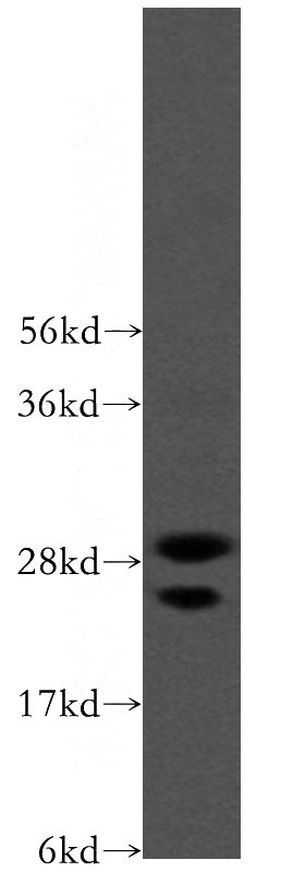 HEK-293 cells were subjected to SDS PAGE followed by western blot with Catalog No:111795(ING4 antibody) at dilution of 1:200