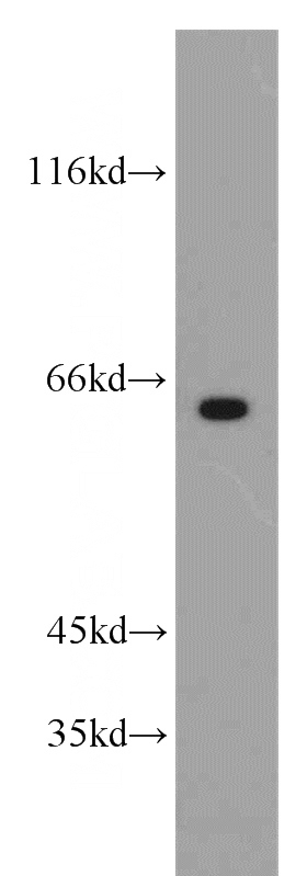 HeLa cells were subjected to SDS PAGE followed by western blot with Catalog No:110462(FAM117B antibody) at dilution of 1:1000