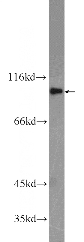 NIH/3T3 cells were subjected to SDS PAGE followed by western blot with Catalog No:110619(FER Antibody) at dilution of 1:1000