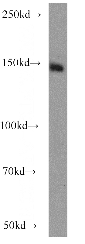 K-562 cells were subjected to SDS PAGE followed by western blot with Catalog No:113601(PASK antibody) at dilution of 1:1000