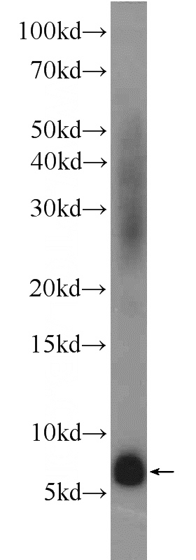 human kidney tissue were subjected to SDS PAGE followed by western blot with Catalog No:107893(ADM Antibody) at dilution of 1:1000