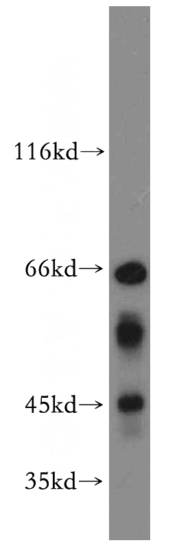 mouse liver tissue were subjected to SDS PAGE followed by western blot with Catalog No:116296(TRIB3 antibody) at dilution of 1:600