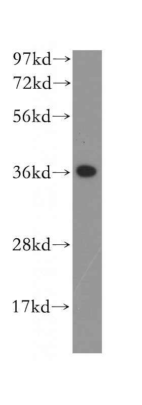 human heart tissue were subjected to SDS PAGE followed by western blot with Catalog No:108064(ANKRD1 antibody) at dilution of 1:400
