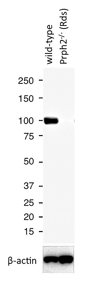 WB results of PDE6B antibody (Catalog No:113666) with WT mouse Eye and Prph2 (Rds) mutant mouse Eye (Negative control). Courtesy of Seongjin Seo, PhD, University of Iowa College of Medicine.