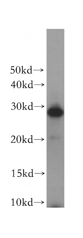 human skeletal muscle tissue were subjected to SDS PAGE followed by western blot with Catalog No:114680(REEP2 antibody) at dilution of 1:200