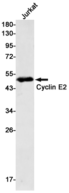 Western blot detection of Cyclin E2 in Jurkat cell lysates using Cyclin E2 Rabbit mAb(1:500 diluted).Predicted band size:47kDa.Observed band size:47kDa.