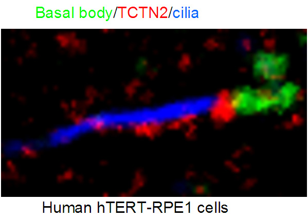 IF result from Dr. Corbit, Kevin. anti-TCTN2(Catalog No:115920) mark the transition zone of Human hTERT-RPE1 cells.