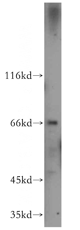 mouse testis tissue were subjected to SDS PAGE followed by western blot with Catalog No:109729(CTPS2 antibody) at dilution of 1:500