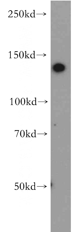 HeLa cells were subjected to SDS PAGE followed by western blot with Catalog No:109731(CTR9 antibody) at dilution of 1:500