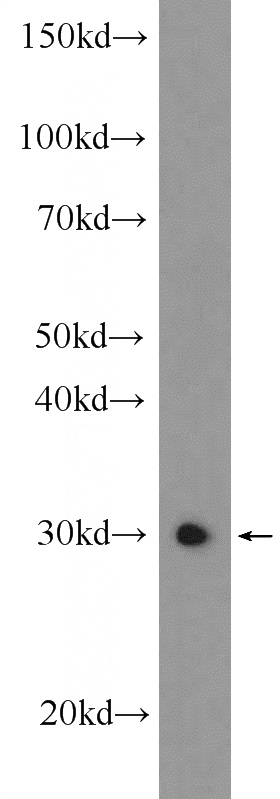 mouse testis tissue were subjected to SDS PAGE followed by western blot with Catalog No:116937(ZCRB1 Antibody) at dilution of 1:600