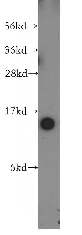 human brain tissue were subjected to SDS PAGE followed by western blot with Catalog No:115869(TBCA antibody) at dilution of 1:500