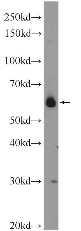 SMMC-7721 cells were subjected to SDS PAGE followed by western blot with Catalog No:109092(CDC14B Antibody) at dilution of 1:300
