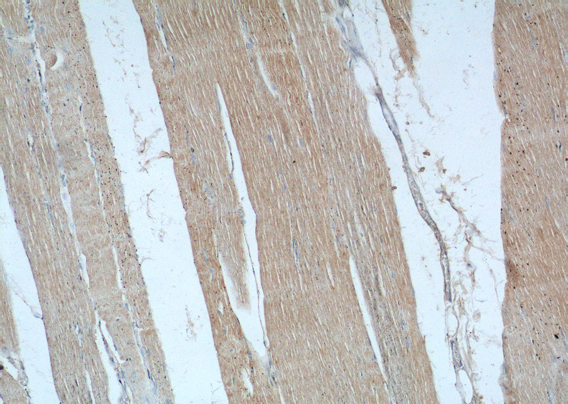 Immunohistochemistry of paraffin-embedded human skeletal muscle tissue slide using Catalog No:114315(PTPN11 Antibody) at dilution of 1:50 (under 10x lens)