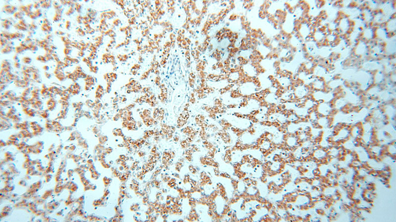 Immunohistochemical of paraffin-embedded human liver using Catalog No:111662(IL15RA antibody) at dilution of 1:50 (under 10x lens)