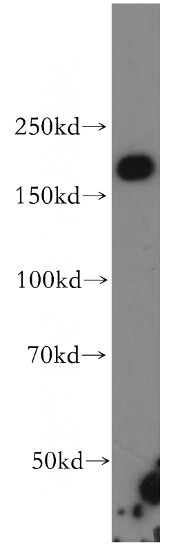 A431 cells were subjected to SDS PAGE followed by western blot with Catalog No:111789(INF2 antibody) at dilution of 1:500