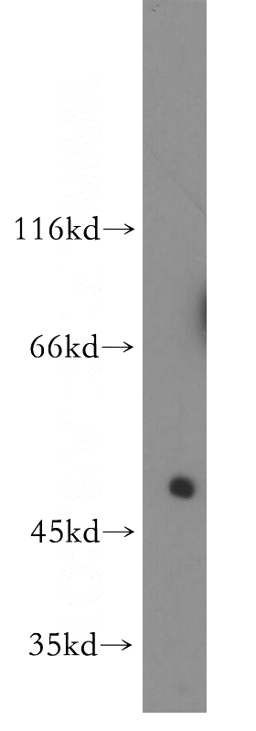 human liver tissue were subjected to SDS PAGE followed by western blot with Catalog No:112223(LILRA2 antibody) at dilution of 1:500