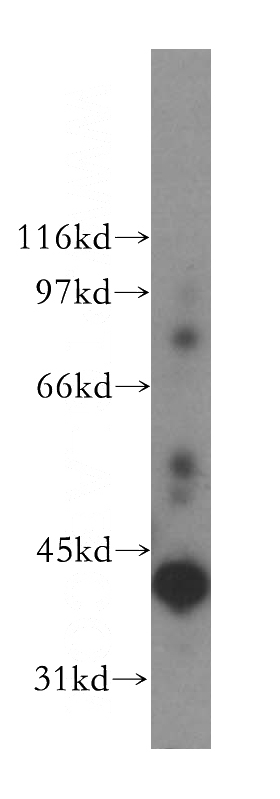 human liver tissue were subjected to SDS PAGE followed by western blot with Catalog No:107789(ADH6 antibody) at dilution of 1:500