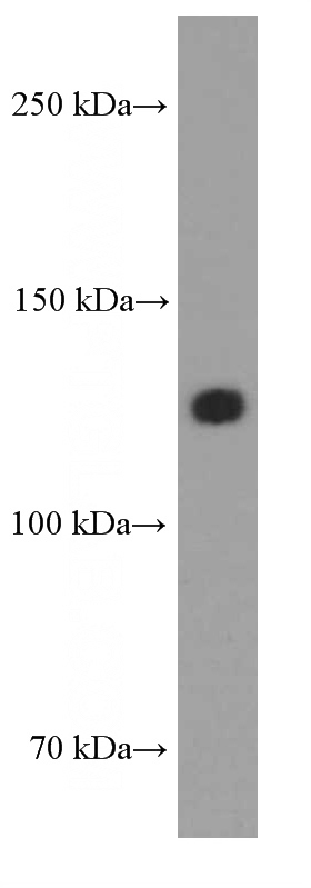 human heart tissue were subjected to SDS PAGE followed by western blot with Catalog No:107322(N-cadherin Antibody) at dilution of 1:2000