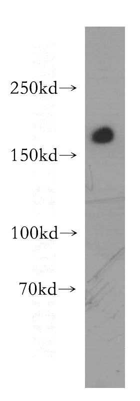 human kidney tissue were subjected to SDS PAGE followed by western blot with Catalog No:109006(MRC1 antibody) at dilution of 1:500