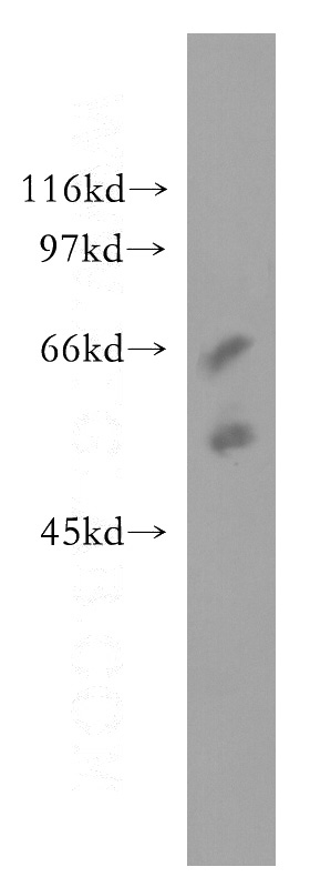 human placenta tissue were subjected to SDS PAGE followed by western blot with Catalog No:115615(SSTR5 antibody) at dilution of 1:1200