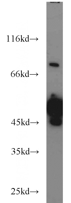 HeLa cells were subjected to SDS PAGE followed by western blot with Catalog No:114575(RCC1 antibody) at dilution of 1:1000