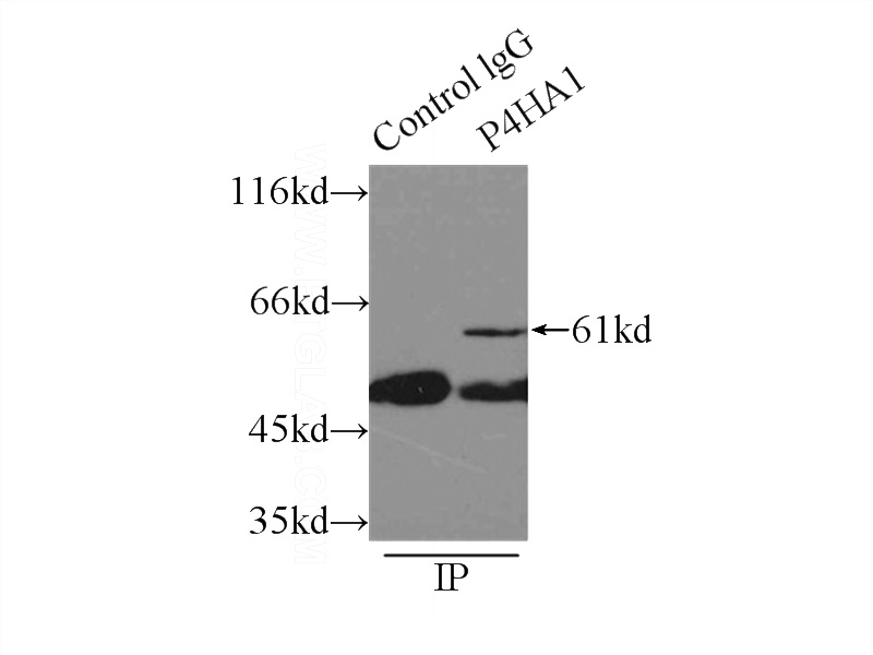 IP Result of anti-P4HA1 (IP:Catalog No:113550, 3ug; Detection:Catalog No:113550 1:600) with A431 cells lysate 3300ug.
