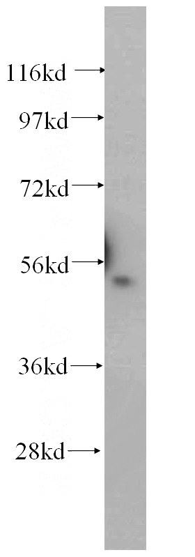 HEK-293 cells were subjected to SDS PAGE followed by western blot with Catalog No:109971(DNPEP antibody) at dilution of 1:500