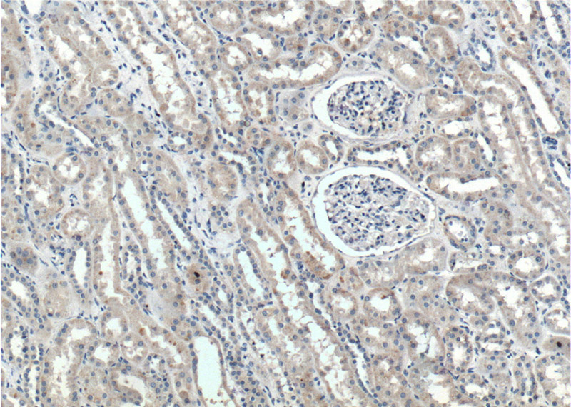 Immunohistochemistry of paraffin-embedded human kidney tissue slide using Catalog No:115476(SNX21 Antibody) at dilution of 1:200 (under 10x lens).
