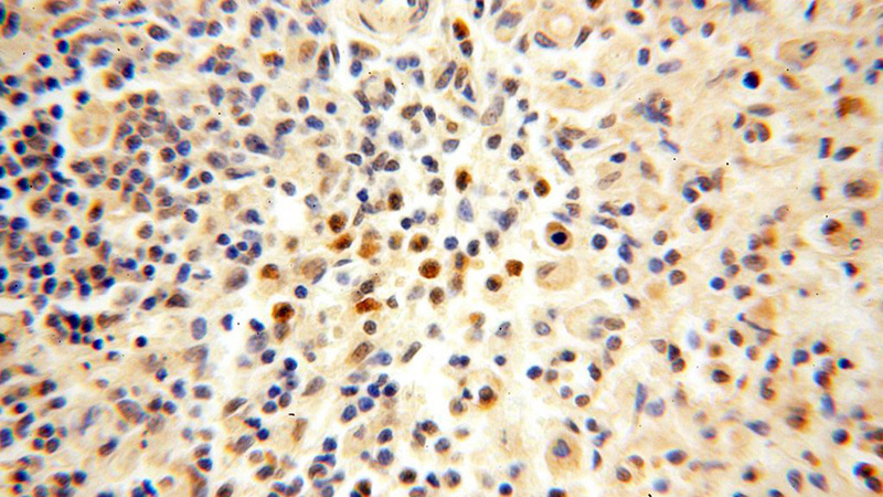 Immunohistochemical of paraffin-embedded human spleen using Catalog No:113158(NFKB2,p52,p100-Specific antibody) at dilution of 1:50 (under 40x lens)