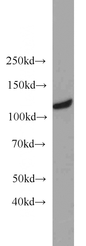 HEK-293 cells were subjected to SDS PAGE followed by western blot with Catalog No:112461(MAML3 antibody) at dilution of 1:2000