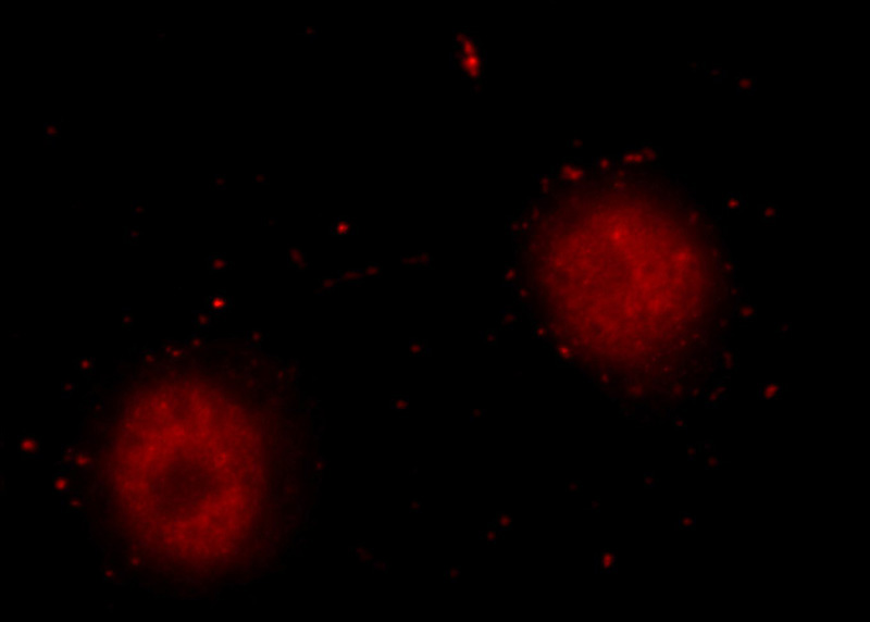 Immunofluorescent analysis of HeLa cells using Catalog No:111510(HNRNPL Antibody) at dilution of 1:25 and Rhodamine-Goat anti-Rabbit IgG