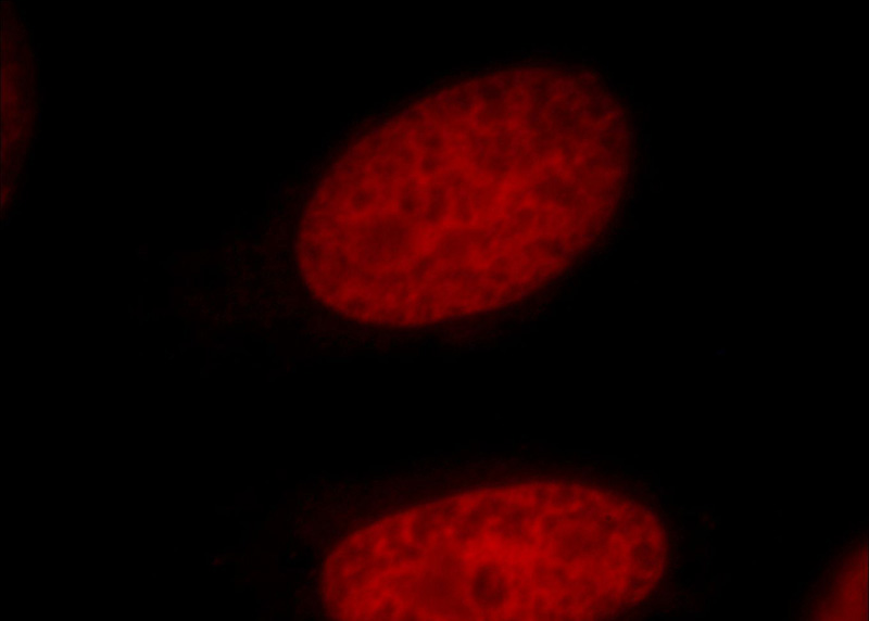 Immunofluorescent analysis of Hela cells, using PDS5A antibody Catalog No:113637 at 1:25 dilution and Rhodamine-labeled goat anti-rabbit IgG (red).
