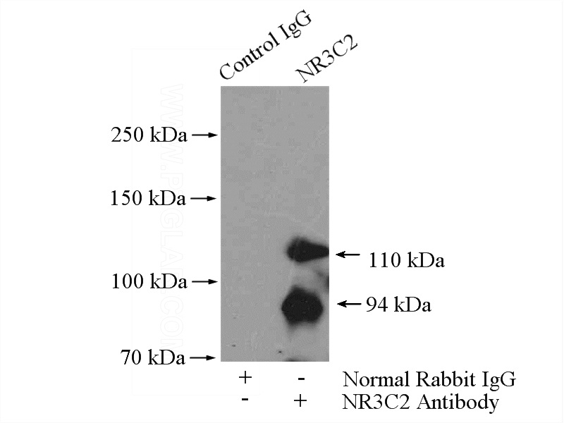 IP Result of anti-NR3C2 (IP:Catalog No:113268, 4ug; Detection:Catalog No:113268 1:500) with HEK-293 cells lysate 3200ug.